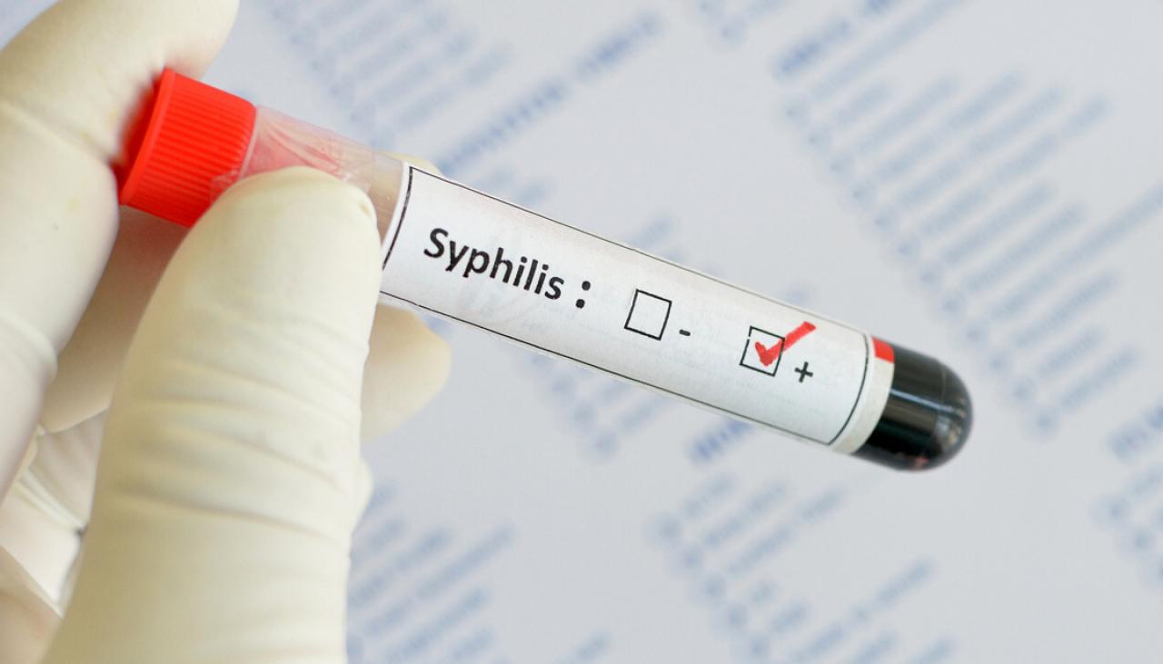 лечение сифилиса в харькове