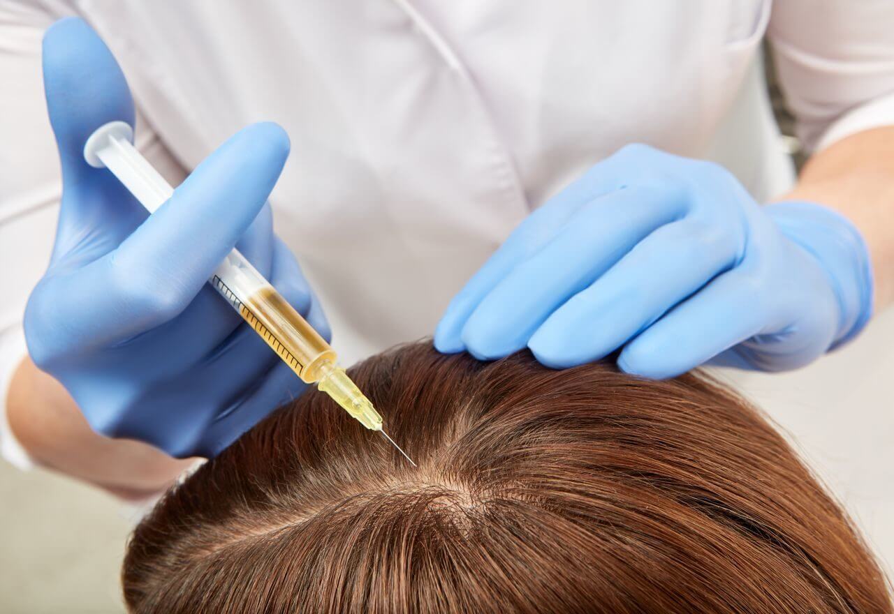 мезотерапия волос цена харьков